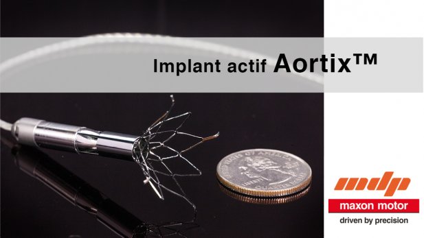 Aortix de maxon, l'implant motorisé pour patients atteints de maladie cardiaque