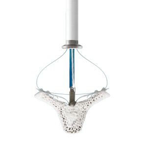 Cardiologie : Chirurgie cardiaque et vasculaire