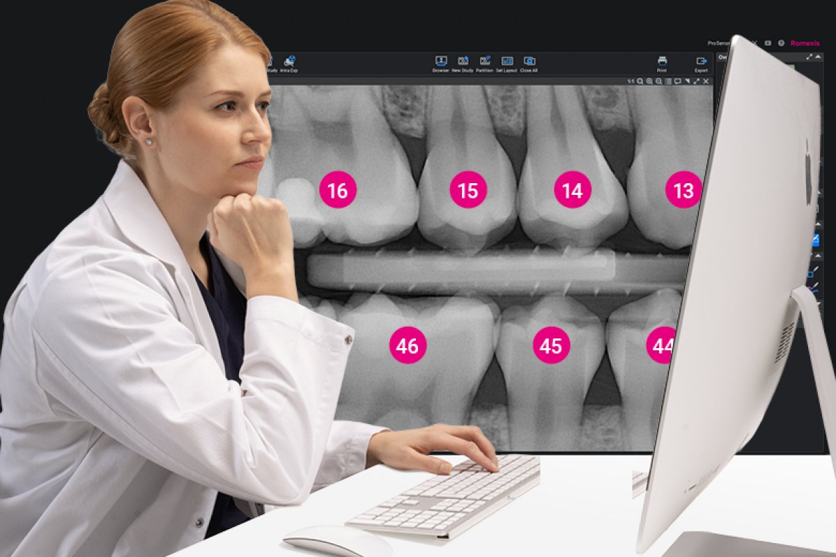 Outils d’IA pour l’imagerie intraorale dans le logiciel Planmeca Romexis® 7